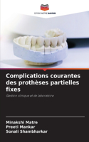 Complications courantes des prothèses partielles fixes