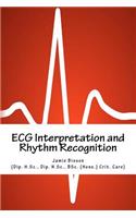 ECG Interpretation and Rhythm Recognition