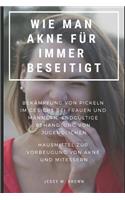 Wie Man Akne Für Immer Beseitigt