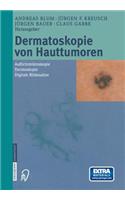 Dermatoskopie Von Hauttumoren