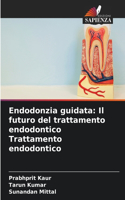Endodonzia guidata