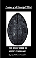 Lesions of A Beautiful Mind