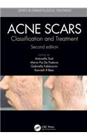 Acne Scars