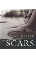 Scars