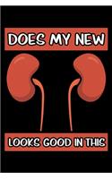 Does My New Kidney Looks Good In This