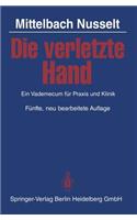 Die Verletzte Hand