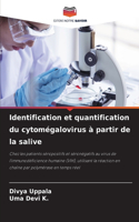 Identification et quantification du cytomégalovirus à partir de la salive