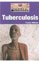Tuberculosis