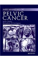 MRI Manual of Pelvic Cancer