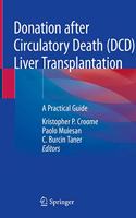 Donation After Circulatory Death (DCD) Liver Transplantation