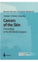 Cancers of the Skin