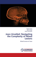 Jaws Unveiled