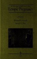 Management of Ectopic Pregnancy (Minimally Invasive Gynecology Series)
