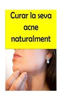 Curar la seva acne naturalment