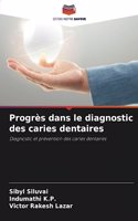 Progrès dans le diagnostic des caries dentaires