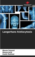 Langerhans histiocytosis