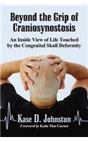 Beyond the Grip of Craniosynostosis: An Inside View of Life Touched by the Congenital Skull Deformity