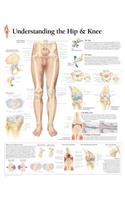Understanding the Hip & Knee Chart