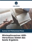 Minimalinvasiver ASD-Verschluss bietet das beste Ergebnis