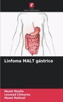 Linfoma MALT gástrico