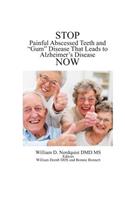 Stop Painful Abscessed Teeth and Gum Disease that Leads to Alzheimer's Now.