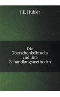 Die Oberschenkelbruche Und Ihre Behandlungsmethoden