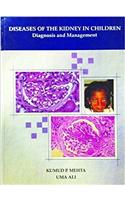DISEASES OF THE KIDNEY IN CHILDREN DIAGNOSIS AND MANAGEMENT