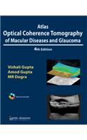 Atlas Optical Coherence Tomography of Macular Diseases and Glaucoma
