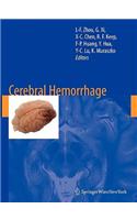 Cerebral Hemorrhage