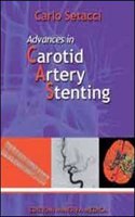 Advances in Carotid Artery Stenting