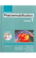 Phacoemulsification