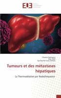 Tumeurs et des métastases hépatiques