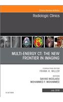 Multi-Energy Ct: The New Frontier in Imaging, an Issue of Radiologic Clinics of North America
