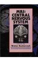 M.R.I. Central Nervous System