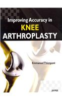Improving Accuracy in Knee Arthroplasty