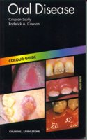 Oral Disease: Colour Guide (Colour Guides) Paperback â€“ 16 March 1999