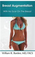 Breast Augmentation With No Scar On The Breast