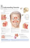 Understanding Sinusitis Paper Poster