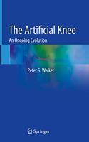 Artificial Knee