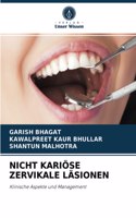 Nicht Kariöse Zervikale Läsionen