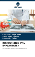 Biomechanik Von Implantaten