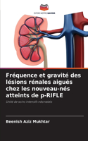 Fréquence et gravité des lésions rénales aiguës chez les nouveau-nés atteints de p-RIFLE