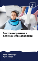 Рентгенограммы в детской стоматологии