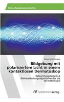 Bildgebung mit polarisiertem Licht in einem kontaktlosen Dermatoskop