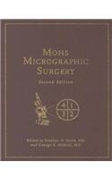 Mohs Micrographic Surgery