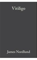 Vitiligo: A Monograph on the Basic and Clinical Science