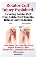 Rotator Cuff Injury Explained. Including Rotator Cuff Tear, Rotator Cuff Bursitis, Rotator Cuff Tendonitis. Symptoms, Exercises, Stretches, Repair, Recovery, Aids, Treatments, Alternative Therapies all covered.