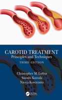 Carotid Treatment: Principles and Techniques