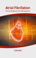 Atrial Fibrillation: Clinical Diagnosis and Management