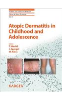 Atopic Dermatitis in Childhood and Adolescence